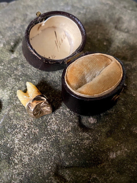 A Rather Macabre Tooth With A Heavy Solid 22ct Gold Crown In An Old Ring Box