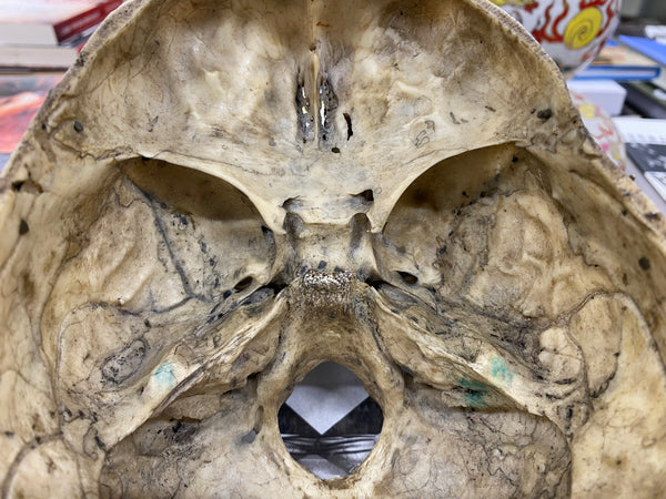 Antique 19th Century Medical Human Skull Teaching Aid - Source Vintage