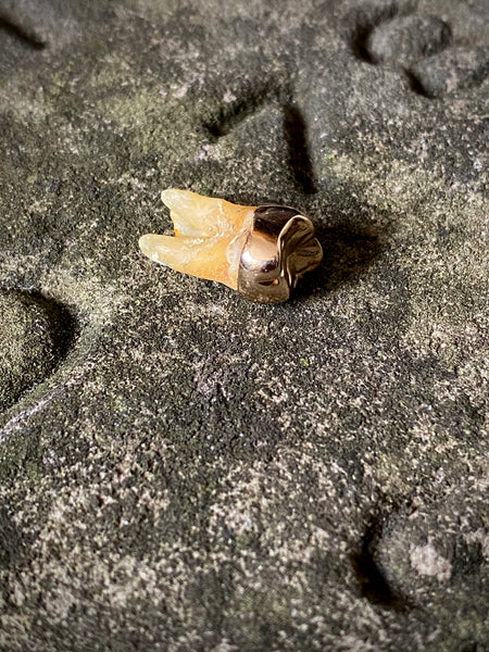 A Rather Macabre Tooth With A Heavy Solid 22ct Gold Crown In An Old Ring Box