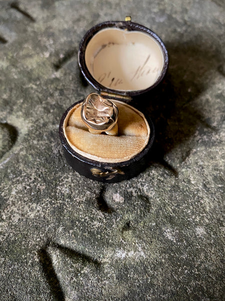 A Rather Macabre Tooth With A Heavy Solid 22ct Gold Crown In An Old Ring Box