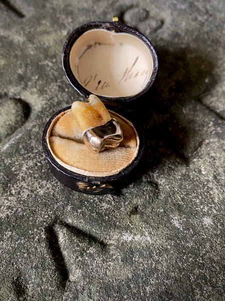 A Rather Macabre Tooth With A Heavy Solid 22ct Gold Crown In An Old Ring Box